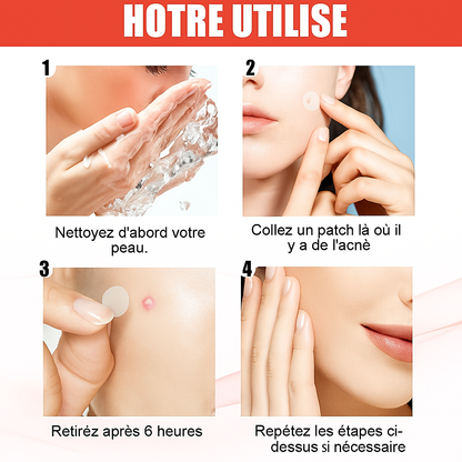 Patch boutons d'acné